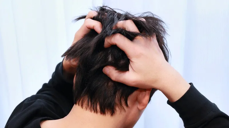 Wat Veroorzaakt Jeuk na een Haartransplantatie?