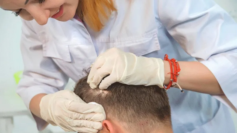 Gezondheidstoerisme voor Haartransplantatie in Turkije